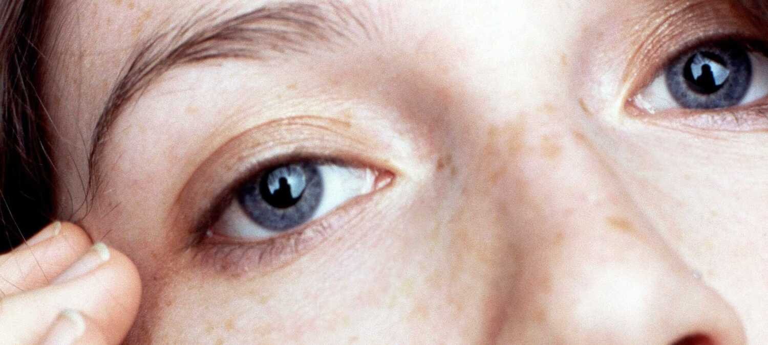 How To Tackle Bags And Dark Circles Under Your Eyes